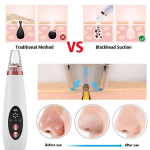 Pore ​​and blackhead cleaner 