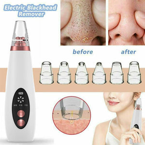 Pore ​​and blackhead cleaner 